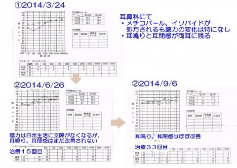 audiograms1